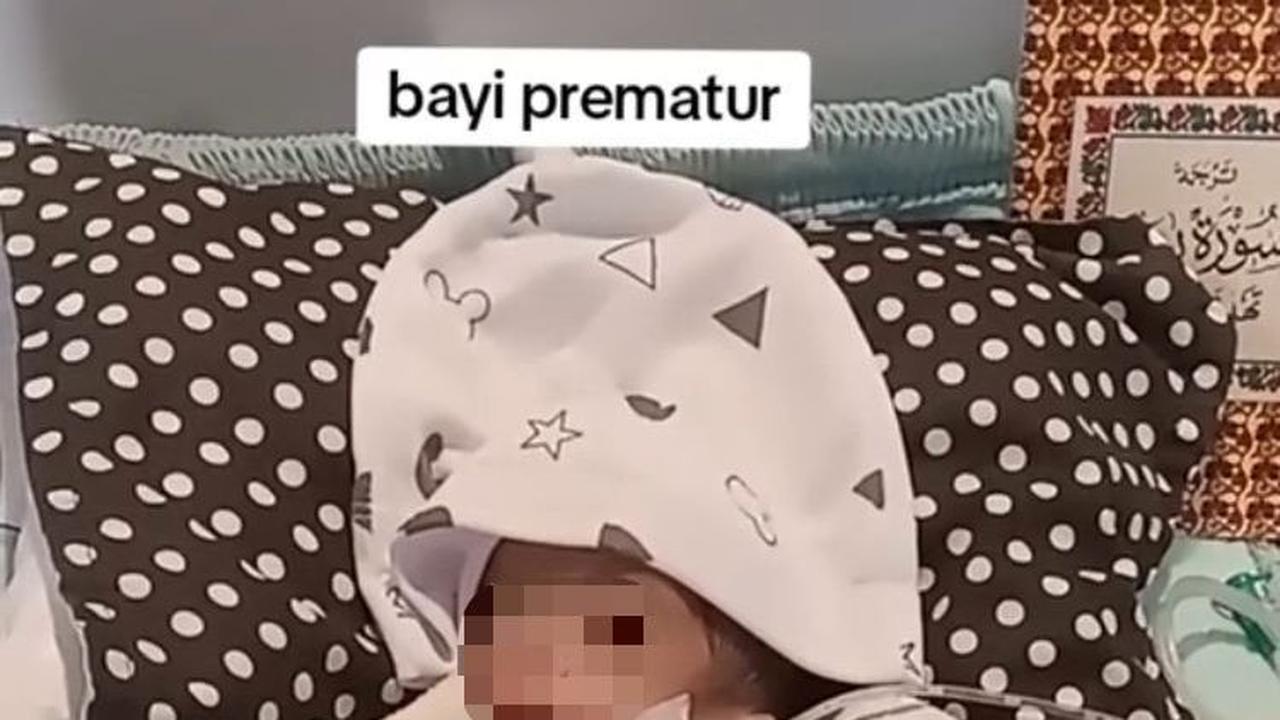 Seperti bayi prematur lain, bayi ini juga memakai selang di bagian hidungnya. Selang ini berfungsi untuk memasukkan susu ke dalam tubuh bayi tersebut.