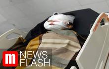 VIDEO: Bocah 8 Tahun Kritis Usai Diserang Anjing Pit Bull