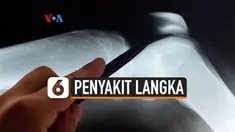 penyakit langka