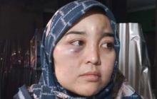 Viral Istri di Garut Diduga Dianiaya Suami hingga Luka Parah karena Dituduh Selingkuh