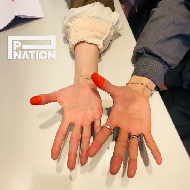 [Fimela] HyunA dan E'Dawn