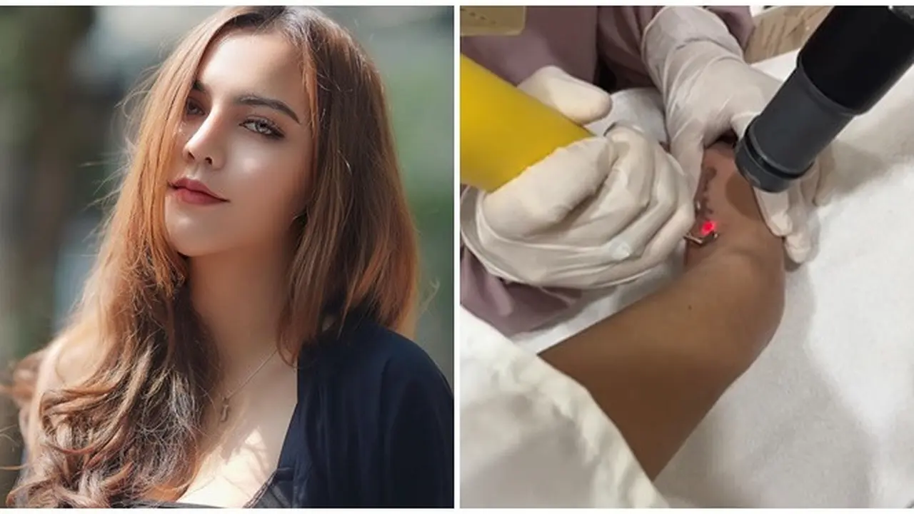 Demi Anak, Ini 6 Momen Ratu Rizky Nabila Hapus 13 Tatonya