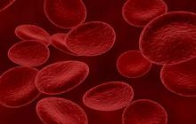 Hindari 10 Jenis Makanan yang Dapat Memicu Anemia, Jangan Anggap Remeh