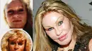 Jocelyn Wildenstein adalah sosialita New York yang terkenal karena berbagai oplas yang ia lakukan. Alih-alih menjadi tambah cantik, janda kaya raya ini justru lebih mirip monster (Istimewa)