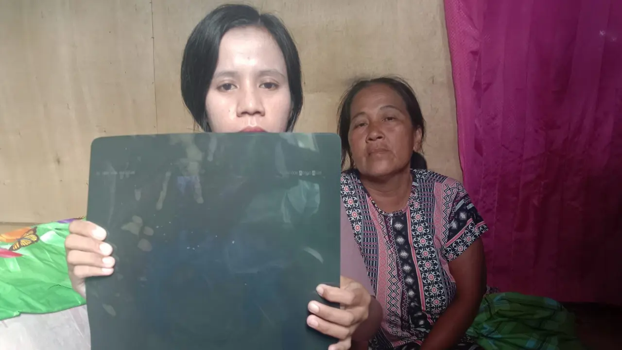 Hastuti, buruh hariab lepas yang alami kecelakaan kerja (Liputan6.com/Ahmad Yusran)