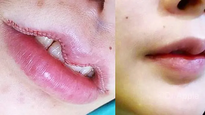 Foto: copyright facebook/dr.apple