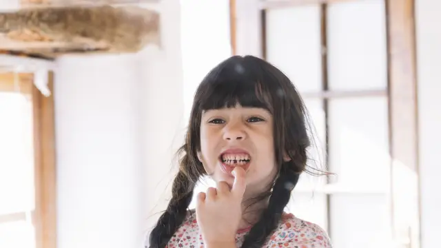 Kenali beberapa kebiasaan yang membuat gigi anak tumbuh tidak teratur