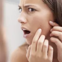 Inilah beberapa cara alami yang dapat kamu andalkan untuk menghilangkan komedo yang sangat mengganggu. (Foto: sev.h-cdn.co)