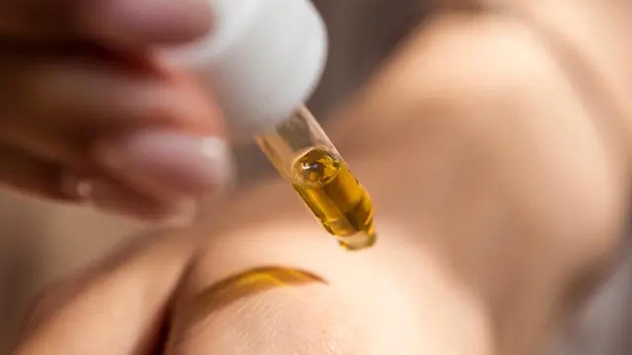 Saran Dokter Tompi Jika Kulit Mati Akibat Pakai Skincare Berlebihan