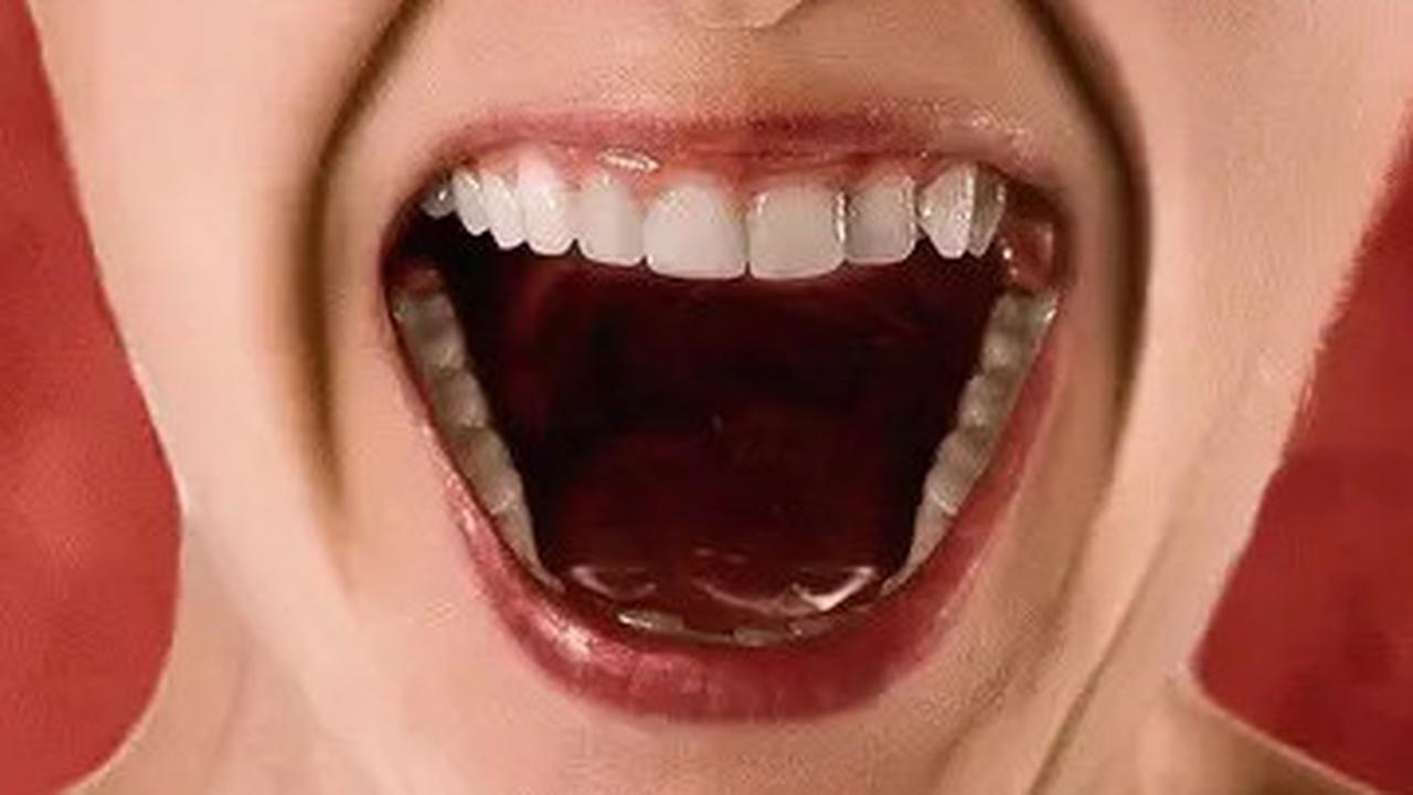 Apa Itu Mewing? Ini Dampak Baik dan Buruknya Menurut Medis