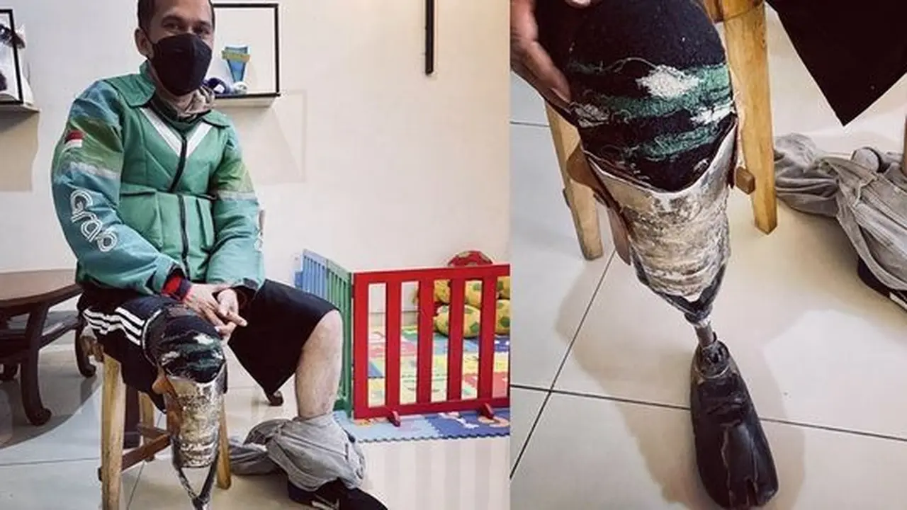 Ojol pakai kaki palsu