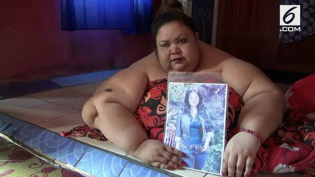 Seorang wanita di Palangkaraya, Kalimantan Tengah mengalami obesitas dan mempunyai berat hingga 300 kg. Kondisi ini membuatnya tak bisa beraktifitas dan butuh bantuan untuk mengecilkan berat badannya.