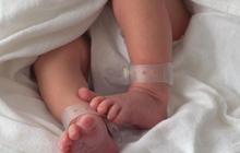Bayi Baru Lahir Ditampar Berkali-kali oleh Dokter Malah Dipuji Netizen, Ternyata ini yang Terjadi