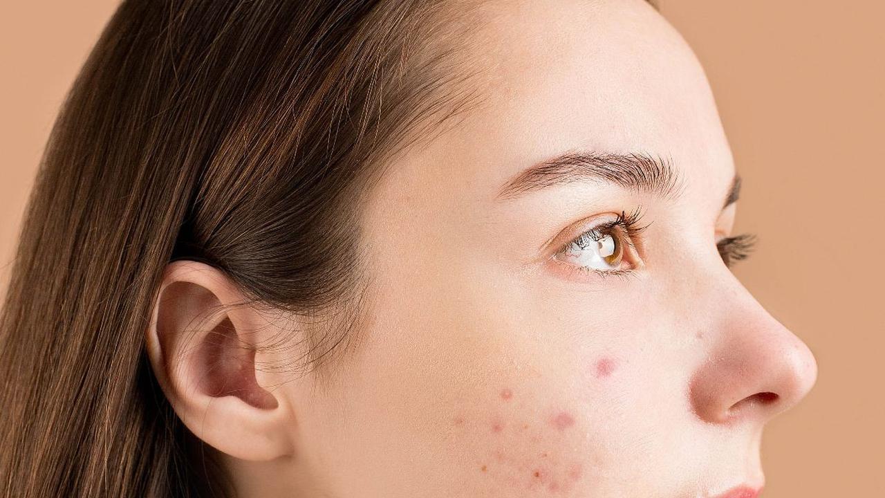 5 Ciri-ciri Skincare Tidak Cocok di Kulit yang Jarang Disadari, Kenali Tandanya