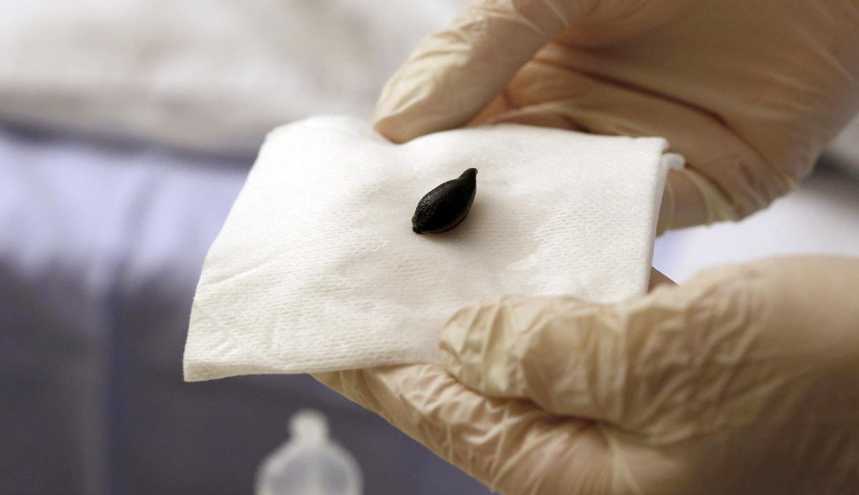 Dokter memperlihatkan lintah yang digunakan untuk terapi, Prancis, (23/11). Air liur lintah diduga memiliki efek anestesi, antiperadangan dan vasodilatasi, atau pelebaran pembuluh darah. (REUTERS / Regis Duvignau)