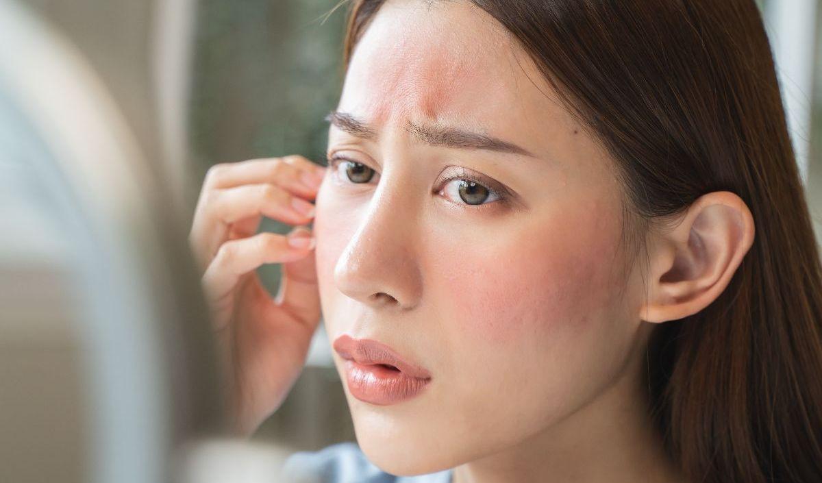 2. Menggunakan Sunscreen Kedaluwarsa