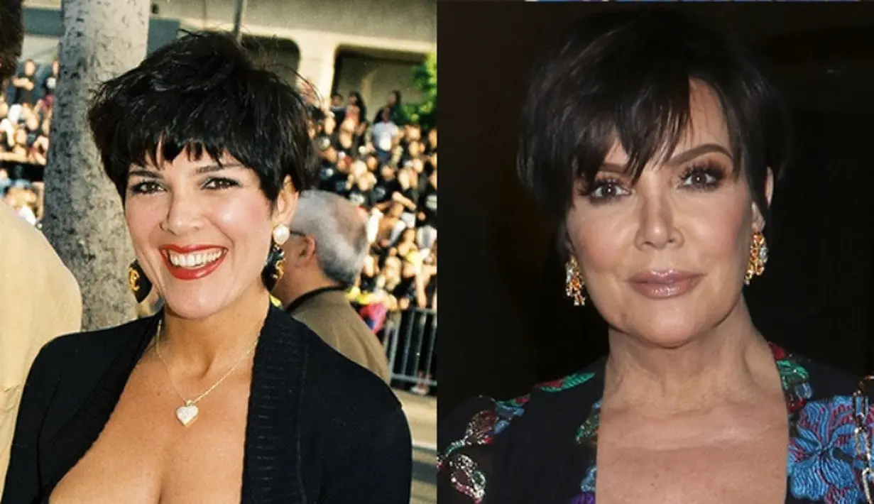 Kris Jenner mengakui bahwa ia melakukan face llift dan membesarkan payudaranya. (Rex/Shutterstock/HollywoodLife)