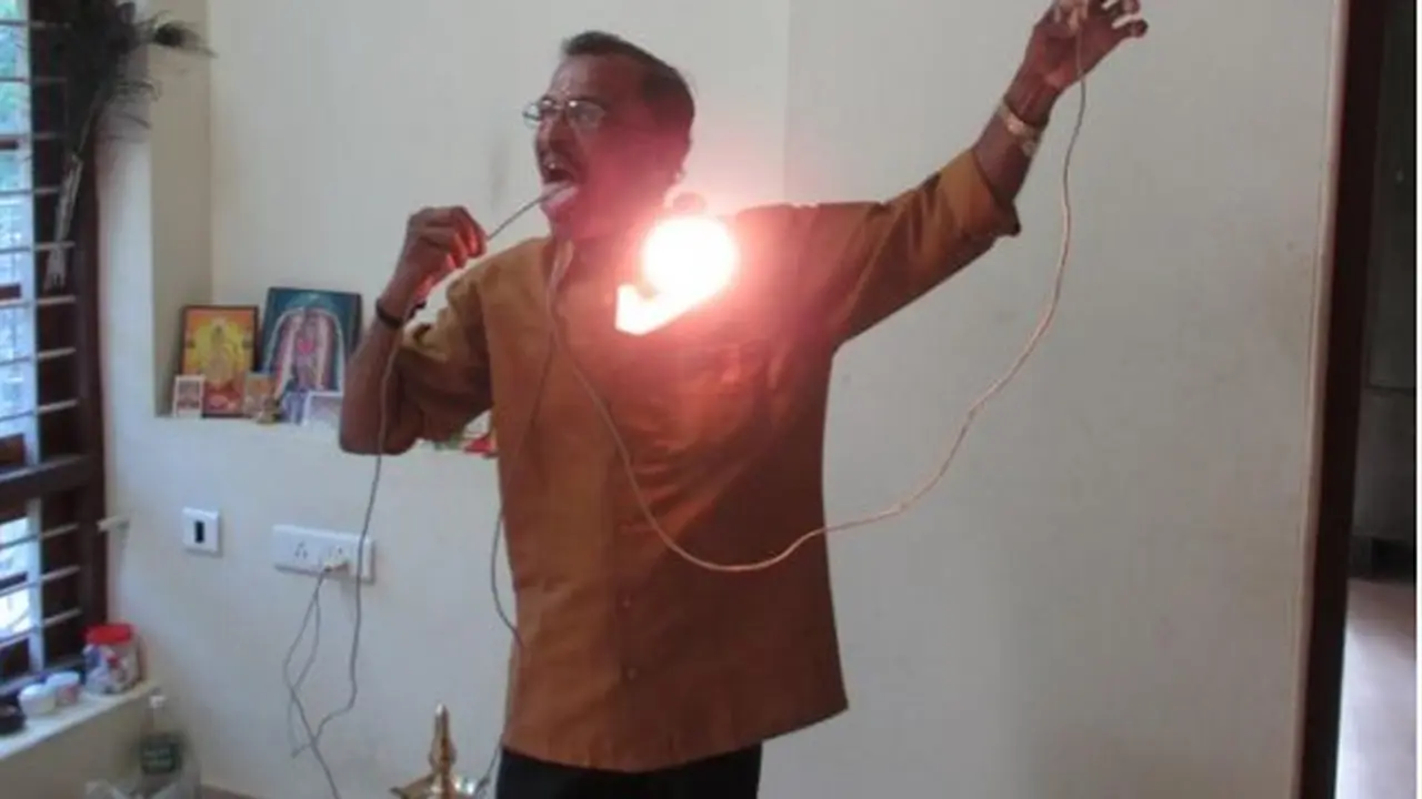 Tubuh Pria Ini Mampu Dilewati Listrik Tegangan Tinggi