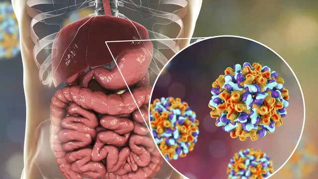 Gejala Penyakit Hepatitis B yang Perlu Diketahui dan Cara Pencegahannya