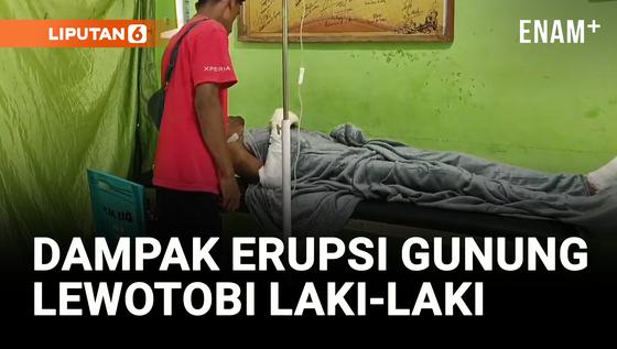 VIDEO: Dua Korban Luka Bakar Serius Dampak Erupsi Gunung Lewotobi Laki-Laki