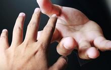 Bayi Kembar Siam Pertama Indonesia, Kini Nasibnya Cemerlang Sukses Jadi Dokter Dulu Ditolong Sosok ‘Malaikat tak Bersayap