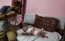 Penyakit Kulit Merajalela di Gaza, Warga Palestina Hidup dengan Air Kotor, Serangga dan Sampah