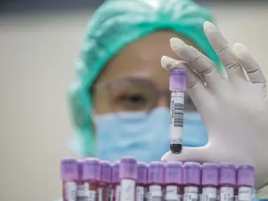 Petugas medis menunjukkan Tes serologi COVID-19 di RS Siloam Kebon Jeruk, Jakarta, Selasa (11/8/2020). Tes serologi antibodi SARS-CoV-2 berbasis lab adalah tes untuk mendeteksi antibodi baik Imunoglobulin M (IgM) dan Imunoglobulin G (IgG) terhadap SARS-CoV-2 dalam darah. (Liputan6.com/Faizal Fanani)