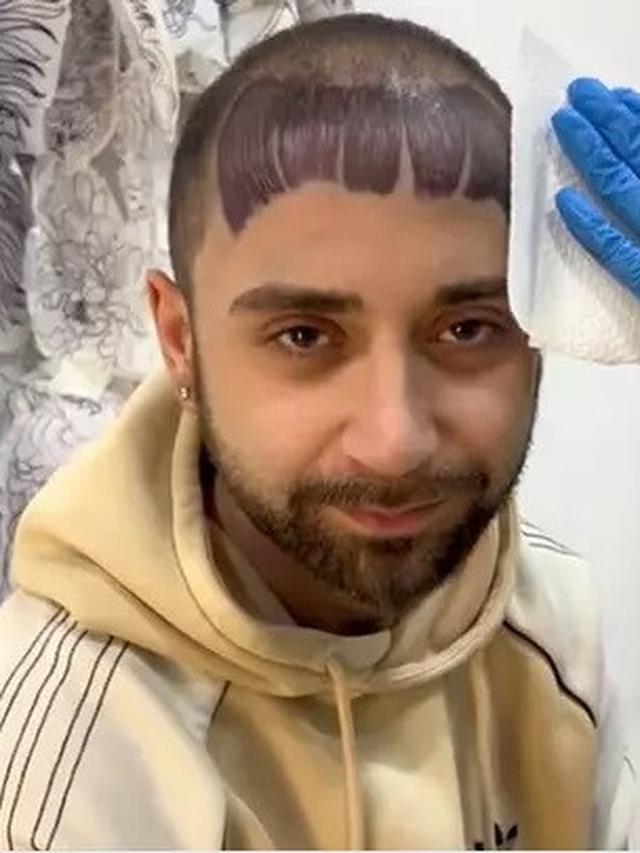 Mentato Kepala Botak