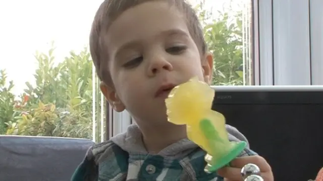 Aneh, Selama Hidupnya Bocah Ini Hanya Bisa Makan Permen