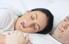Terbiasa Tidur dengan Mulut Diplester 'Mouth Taping', ini Dampaknya bagi Kesehatan