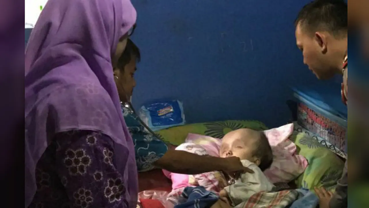 Penderita hydrocephalus di Bogor