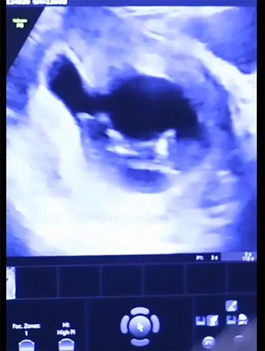 "We've Been keeping a little secret! Syukur Alhamdulillah," tulis kikiamaliaworld membagika video singkatnya yang diunggah 11 September.[Instagram/kikiamaliaworld]