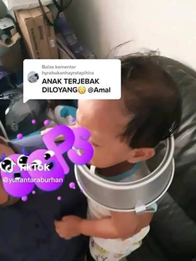 7 Potret Kepala Bocah Terjebak di Berbagai Benda dan Tempat Nyeleneh Ini Kocak