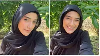 Potret Nadya Mustika Pamer Senyum Kelihatan Gigi. (Sumber: Instagram/nadyamustikarahayu)