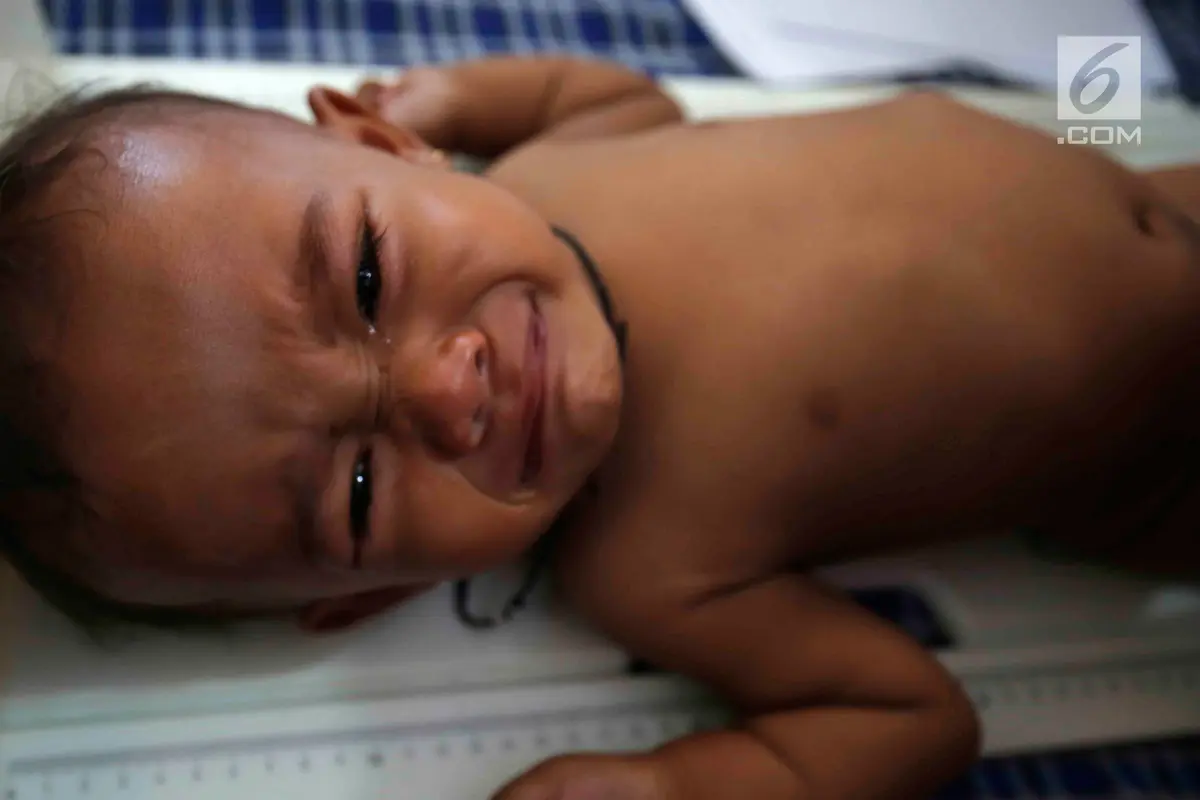 Melihat Kondisi Anak-Anak Kurang gizi di Pandeglang