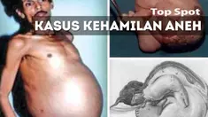 Beberapa kejadian unik terkait kehamilan ini akan membuat anda keheranan dan geleng-geleng kepala.