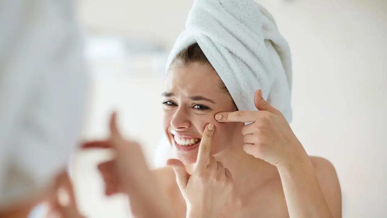 ilustrasi kandungan spot treatment yang ampuh mengatasi jerawat/Pressmaster/shutterstock