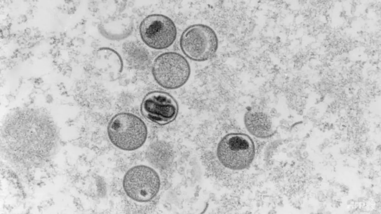 Tangkapan mikroskop elektron bagian ultratipis dari virus cacar monyet file 2004. (Gambar: AFP/RKI Institut Robert Koch/Freya Kaulbars)