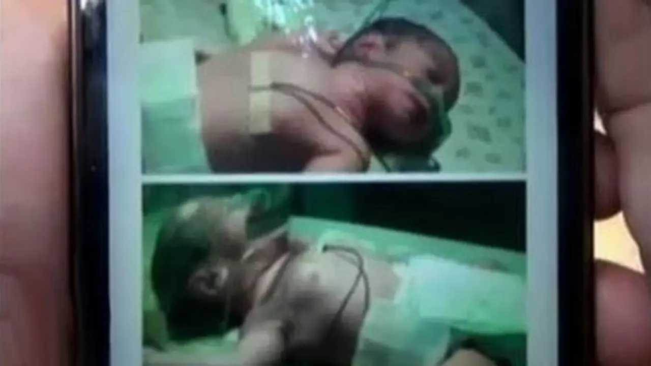 Segmen 4: Kabut Asap Riau hingga Bayi kembar Ditahan Rumah Sakit