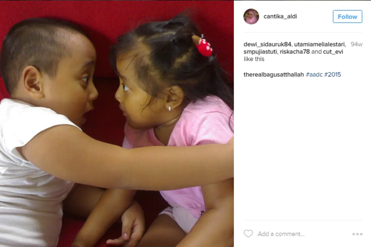 [Bintang] Cantika Mendiang Anak Komeng