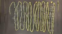 Cacing pita sepanjang 2,8 meter ditemukan di dalam tubuh seseorang di Singapura pada 2016. Temuan itu menjadi salah satu contoh kasus infeksi parasit yang cukup mengkhawatirkan di SIngapura (sumber: Departemen Mikrobiologi Singapore General Hospital)