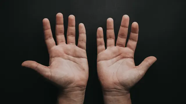 Ilustrasi tangan gatal. Photo by Luis Quintero on Unsplash