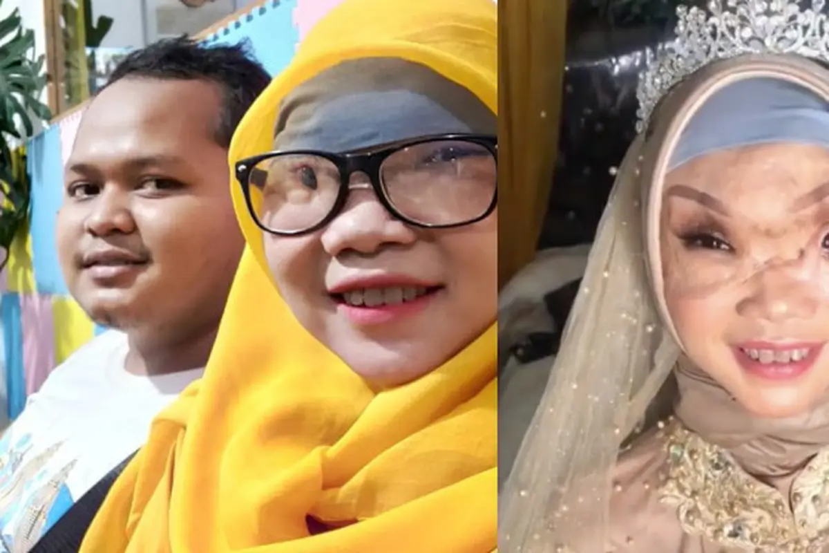 Kabar Terbaru Ayu Korban Kecelakan Perahu, Kini Sudah Temukan Cinta Sejati