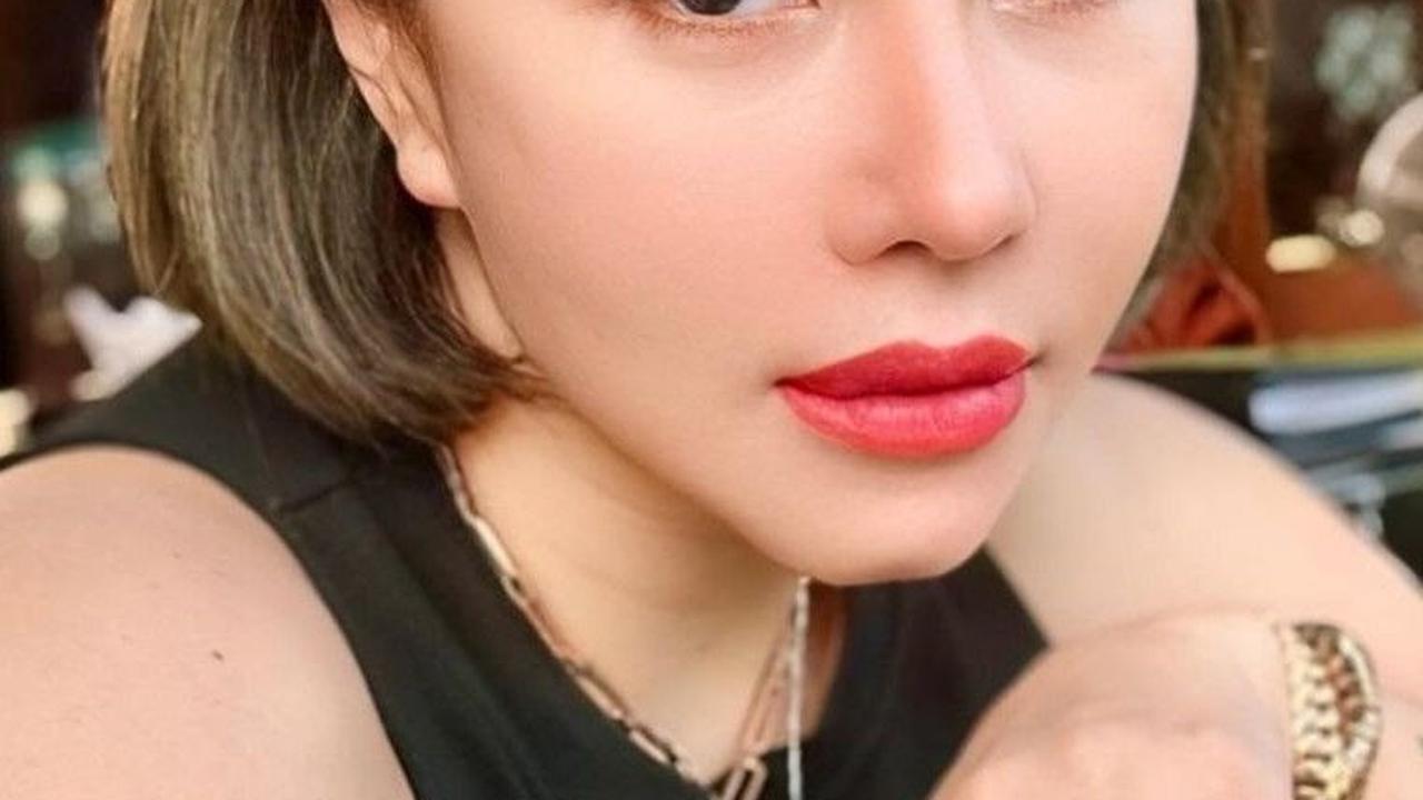 Pernah Koma Hingga Amnesia dan Tak Kenali Orang <br>
