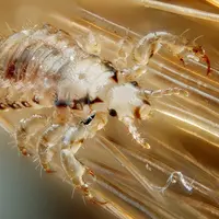 Ternyata, selain kutu kemaluan, ada beberapa penyakit seksual lainnya yang tak bisa dicegah dengan penggunaan kondom!