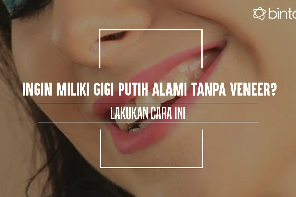 Ingin Miliki Gigi Putih Alami Tanpa Veneer? Lakukan Cara Ini