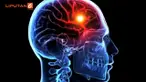 Di Indonesia, stroke merupakan penyebab kematian dan kecacatan utama. Data Riskesdas bahkan menunjukkan, peningkatan prevalensi stroke dari 8,3 per 1.000 penduduk pada 2007 menjadi 12,1 per 1.000 penduduk pada 2013.