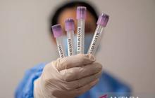 Dinkes DKI Temukan 3 Kasus Positif Hantavirus, 6 Suspek Masih Dipantau