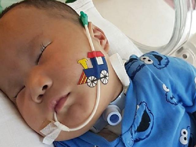 Bayi Lucu Dengan Penyakit Langka Adam Fabumi Meninggal Dunia Health Liputan6 Com