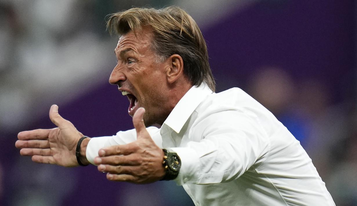 Pelatih asal Prancis berusia 54 tahun ini tak segan berteriak lantang mengingatkan para pemainnya jika instruksinya tak dijalankan sesuai rencana di atas lapangan. (AP/Manu Fernandez)